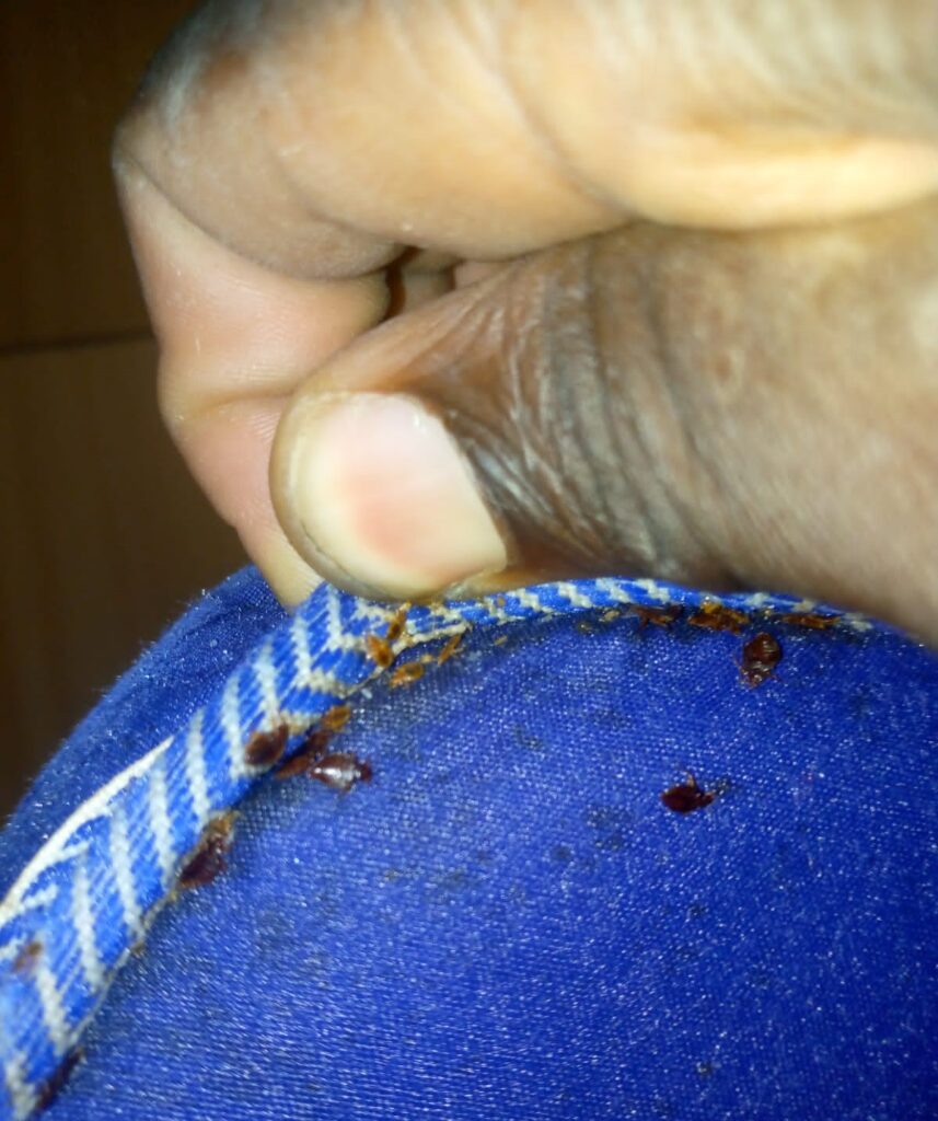 bed bugs in a mattress - Agile Pest Control_ Nairobi Kenya